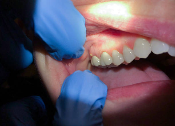 Best Tooth Infection Emergency Dentist  in Delft Colony, CA