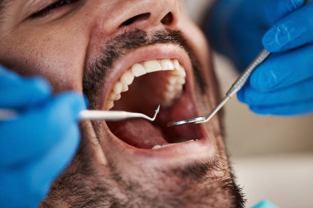 Best Emergency Dentist for Kids  in Delft Colony, CA