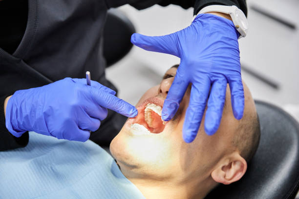 Best Emergency Tooth Extraction  in Delft Colony, CA